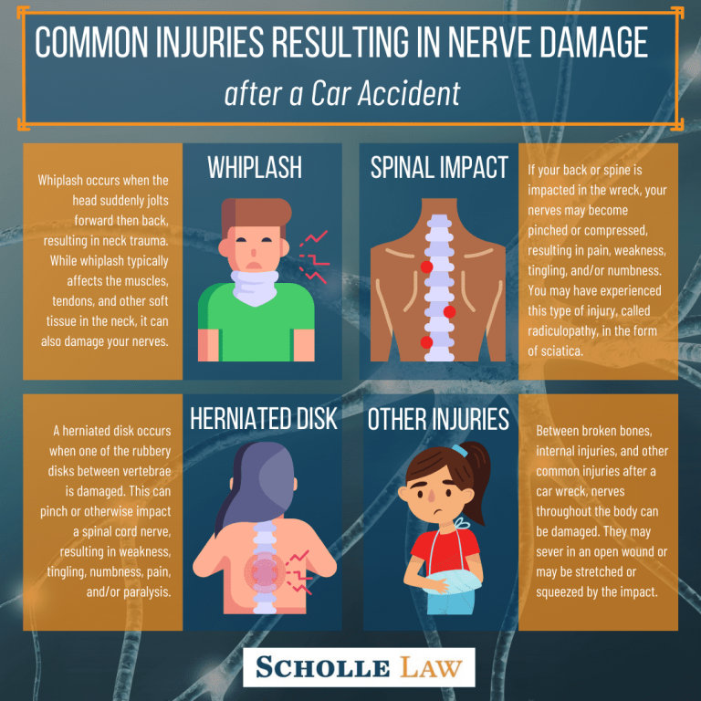 Can A Car Accident Cause Neuropathy?