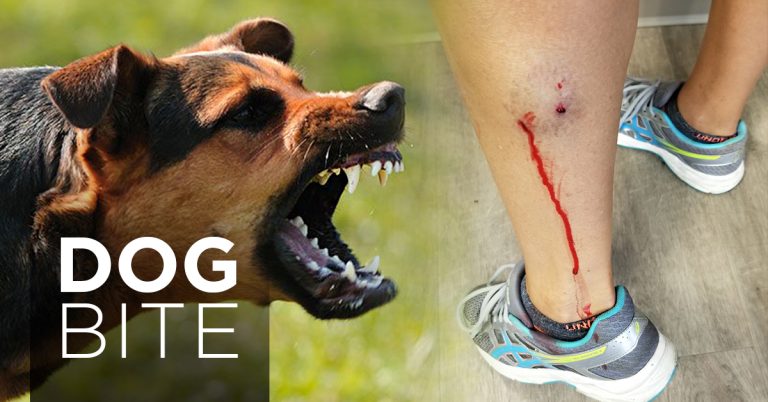 Establishing Liability In Dog Bite Cases: Key Considerations