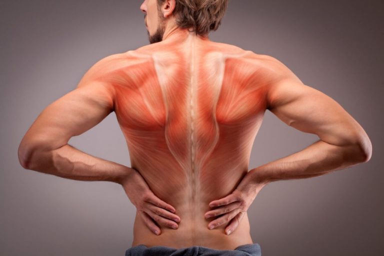 How To Treat Lower Back Pain After Car Accident?